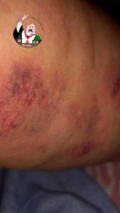 سلطانة,خيا,حقوق,الإنسان,الصحراء,الغربية